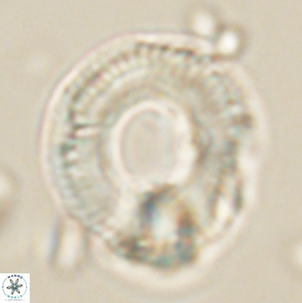 Diadelithus robustus 63227