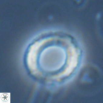Diadelithus robustus 70733