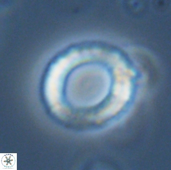 Diadelithus robustus 70734