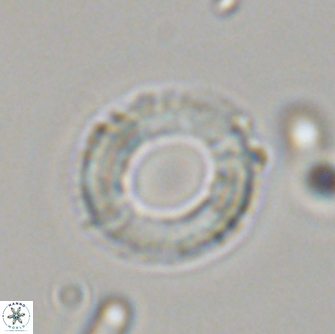 Diadelithus robustus 70736
