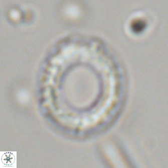 Diadelithus robustus 70737
