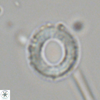 Diadelithus robustus 70738