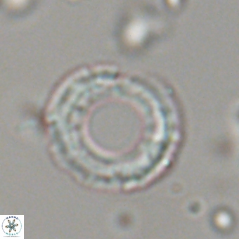 Diadelithus robustus 70800