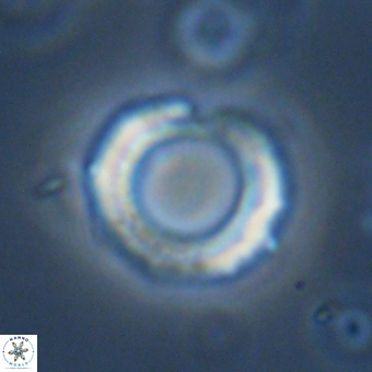 Diadelithus robustus 70802