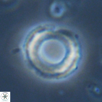 Diadelithus robustus 70803