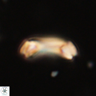 Diadelithus robustus 70804