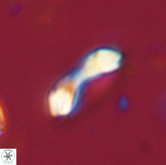 Diadelithus robustus 70812