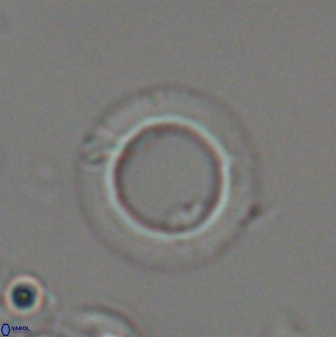 Diadelithus robustus 24574