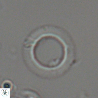 Diadelithus robustus 24574