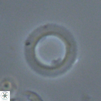 Diadelithus robustus 24575