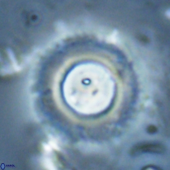 Diadelithus robustus 24538