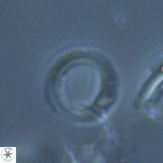 Diadelithus robustus 24650