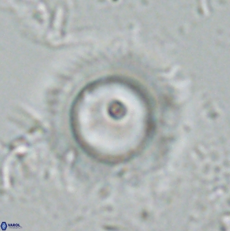 Diadelithus robustus 24765
