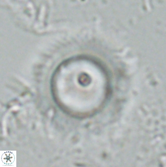 Diadelithus robustus 24765