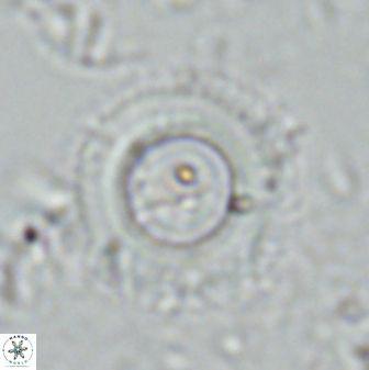 Diadelithus robustus 24766