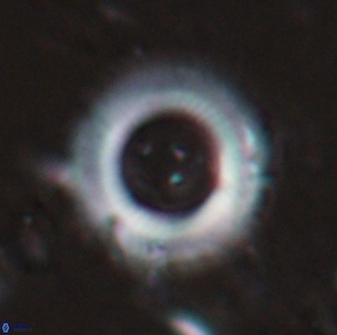 Diadelithus robustus 24728