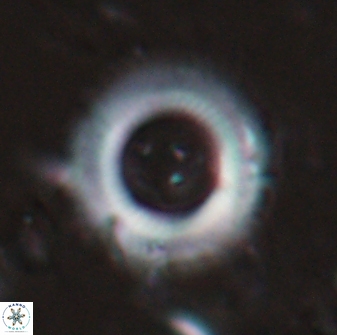 Diadelithus robustus 24728