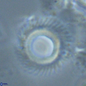 Diadelithus robustus 24970
