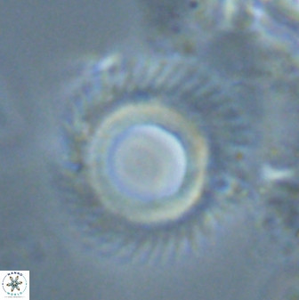 Diadelithus robustus 24970
