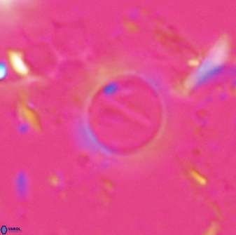 Diadelithus robustus 25119