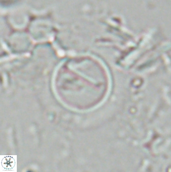 Diadelithus robustus 25120