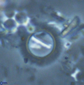 Diadelithus robustus 25121