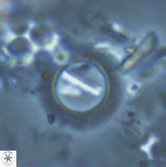 Diadelithus robustus 25121