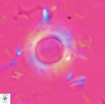 Diadelithus robustus 25733