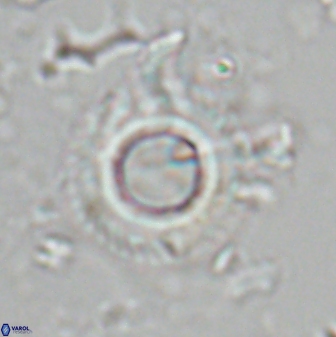 Diadelithus robustus 25734