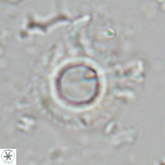 Diadelithus robustus 25734