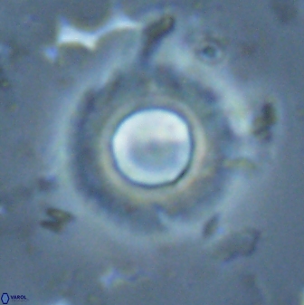 Diadelithus robustus 25735