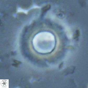 Diadelithus robustus 25735