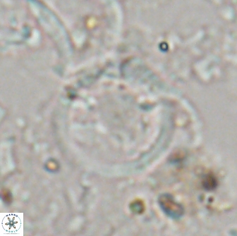 Diadelithus sp 21076
