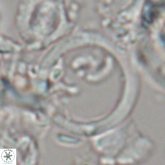 Diadelithus sp 21477