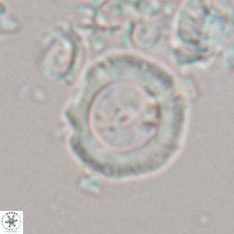 Diadelithus sp 21590