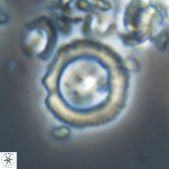 Diadelithus sp 21591