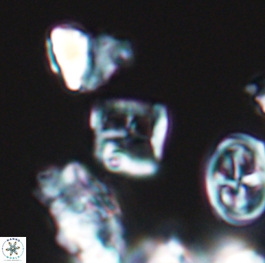 Diadorhombus rectus 12434