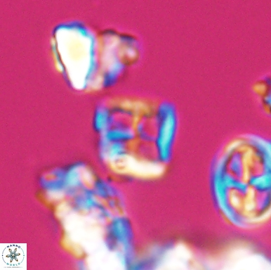Diadorhombus rectus 12435