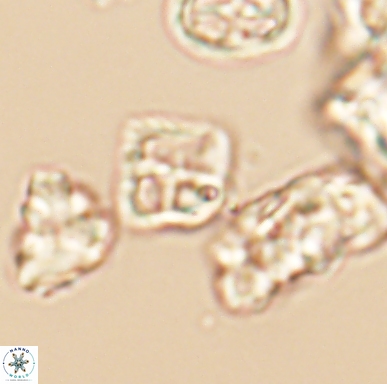 Diadorhombus rectus 12436