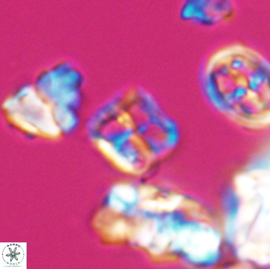 Diadorhombus rectus 12433