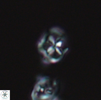 Diadorhombus rectus 13409