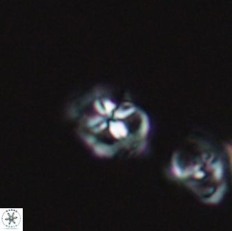 Diadorhombus rectus 13411