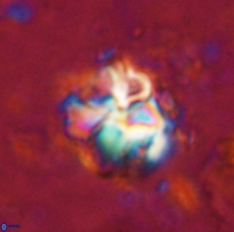Diantholitha mariposa 50535