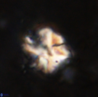 Diantholitina mariposa 50464