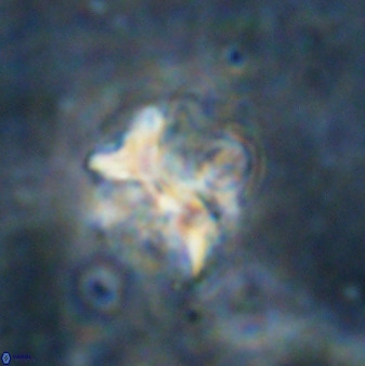 Diantholitina mariposa 50474