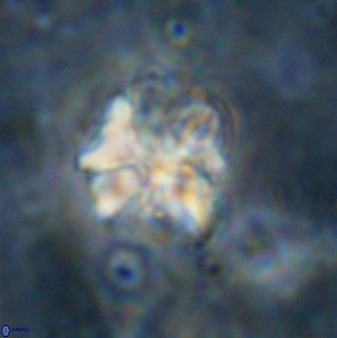 Diantholitina mariposa 50475