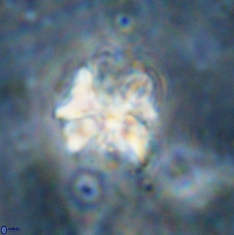 Diantholitina mariposa 50476