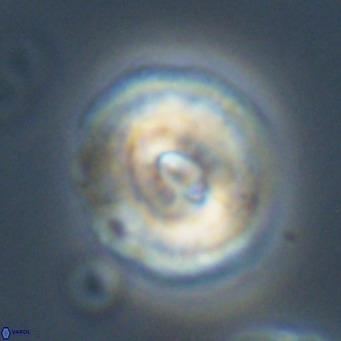 Dictyococcites filewiczii VR 31955