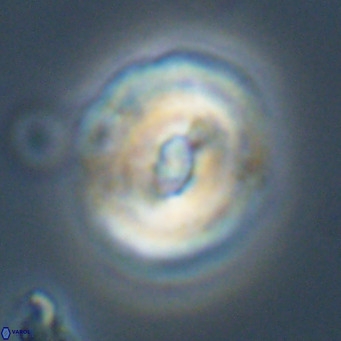 Dictyococcites filewiczii VR 31953