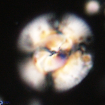 Dictyococcites stavensis VR 29364